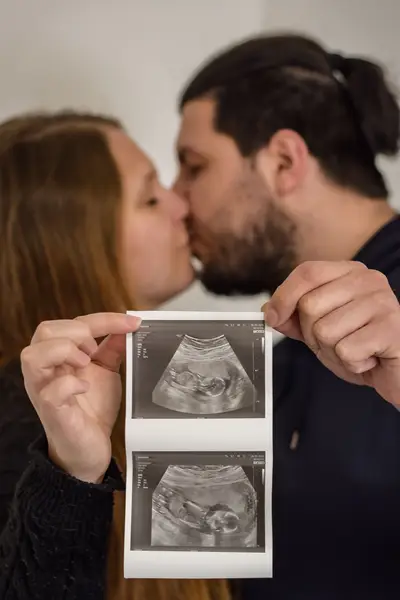 Těhotenské focení - Fotografie č. 4