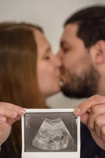 Těhotenské focení - Fotografie č. 2