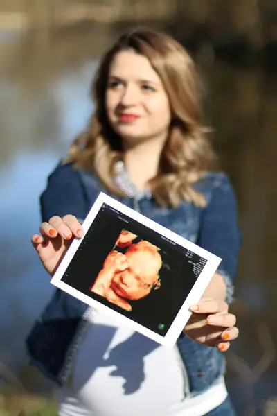 Těhotenské focení Jiří Čermín - Fotografie č. 5